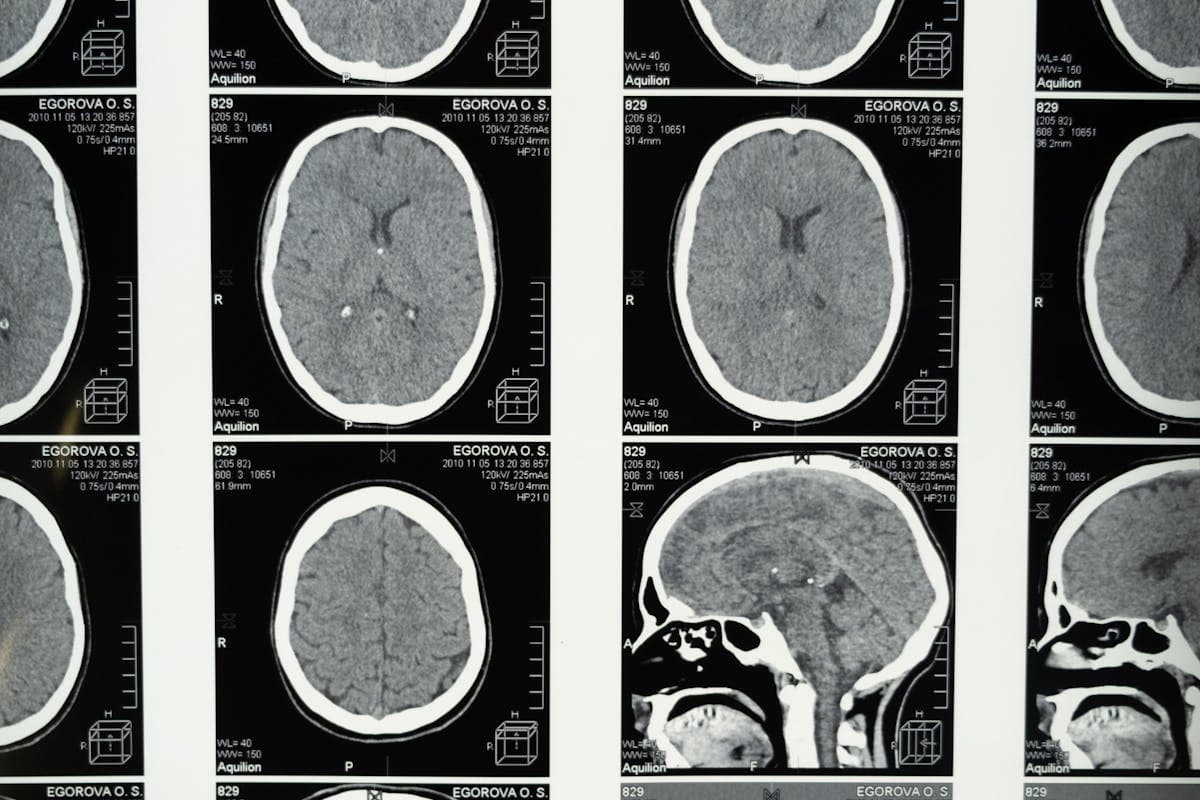 Shilajit Benefits for Brain: Cognitive Mechanism Map